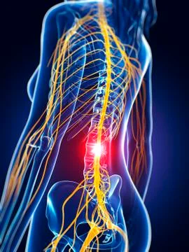 Human nerve pain, artwork Illustrazione stock