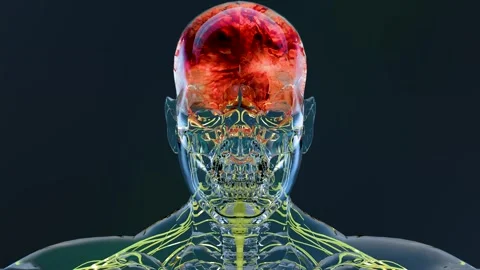 Human Nervous System and Transparent Head Highlighting Brain Inflammation Video stock 347474748