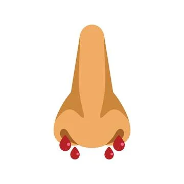 Human nose bleeding with blood drops flowing downwards Stock Illustration