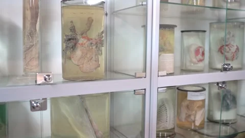 Human organs in jars with formalin in anatomical museum 库存影片 134491088