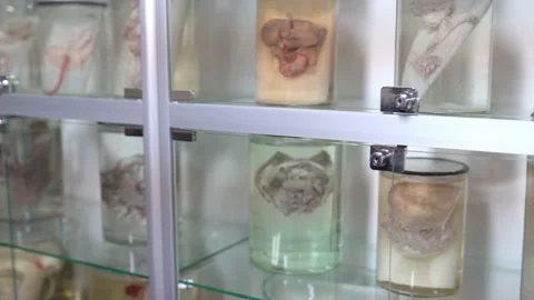 Human organs in a jars (real specimen) Stock Footage 134491089