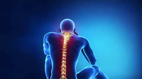 Human pain with backache / headache Stock Footage