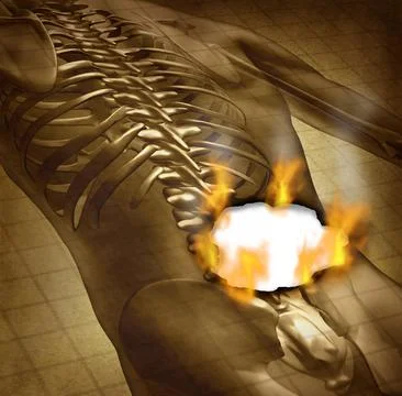 Human Painful Back Illustration