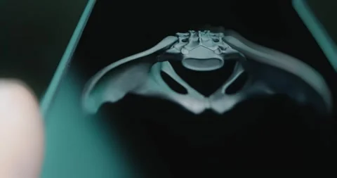 Human pelvis bones view from different angles Stock Footage 313838945