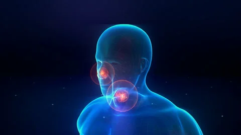 Human phantom with a pains Stock Footage 38495655