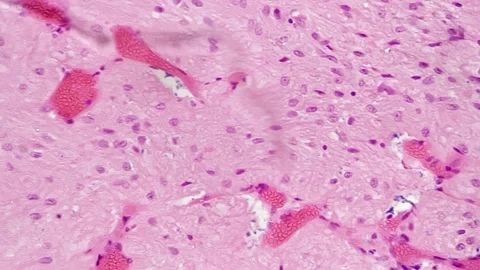 Human pituitary gland in cross section under microscope with 200 times Stock Footage 228576828