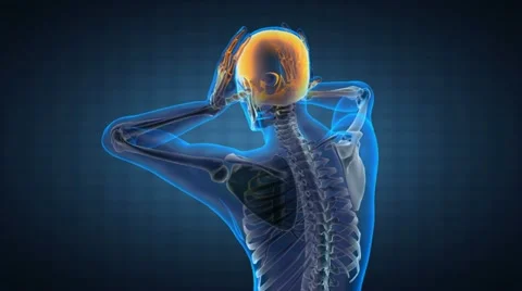 Human radiography scan Видео 10826957