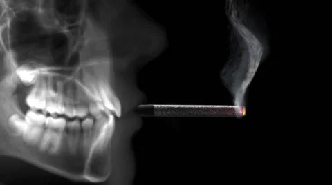 Human radiography smoking a cigarette Stock Footage 68637765