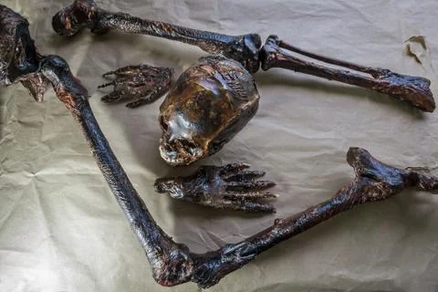 Human remains are on the table in front of forensics. The view from above. Stock Photos
