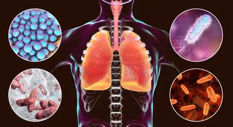 Human respiratory pathogens Illustrazione stock