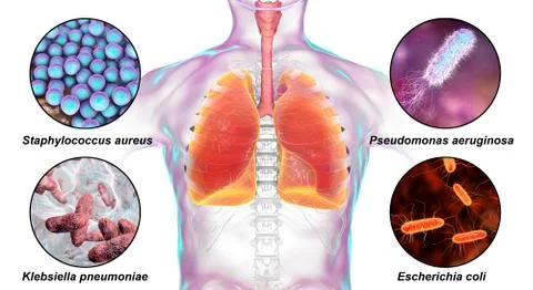 Human respiratory pathogens Illustrazione stock