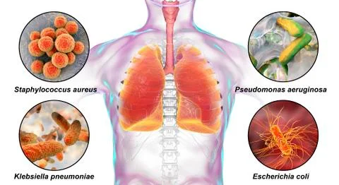 Human respiratory pathogens Illustrazione stock
