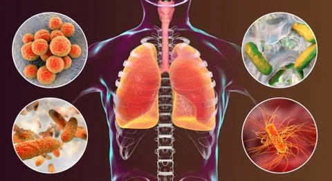 Human respiratory pathogens Illustrazione stock