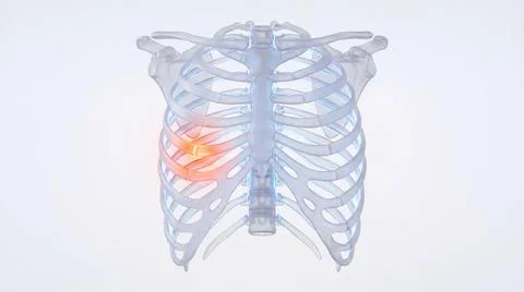Human rib cage anatomical model with highlighted orange area representing c.. Stock Illustration