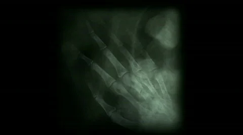 Human rib finger bone scan tech medical X-ray medical research body health. Stock Footage 809227