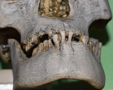 Human scull Stock Photos