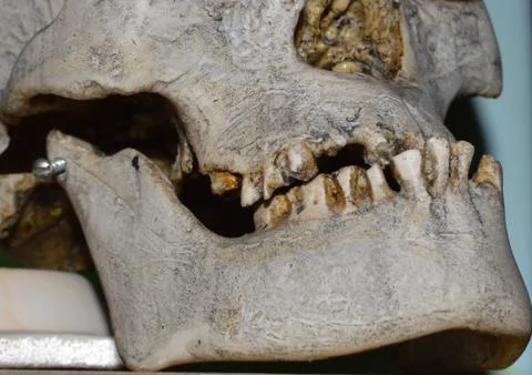 Human scull Stock Photos