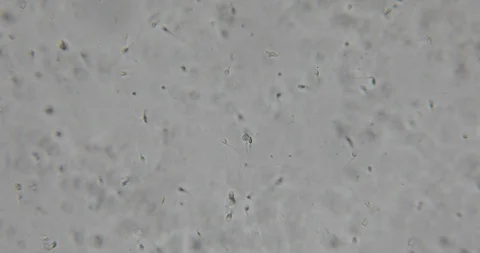 Human semen in phase contrast microscope 動画素材 129409116