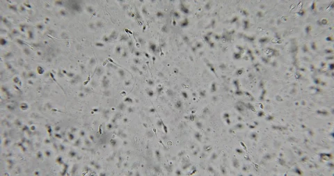 Human semen in phase contrast microscope 動画素材 129409150