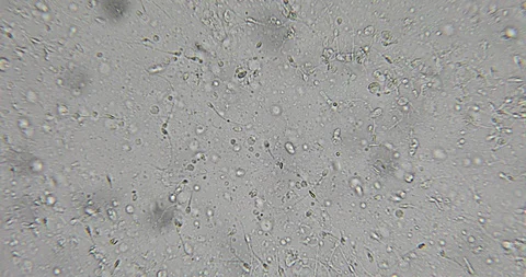 Human semen in phase contrast microscope Stock Footage 129409161
