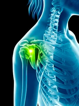 Human shoulder joint, illustration Stock Illustration