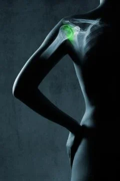 Human shoulder joint in x-ray, on gray background. Stock Photos