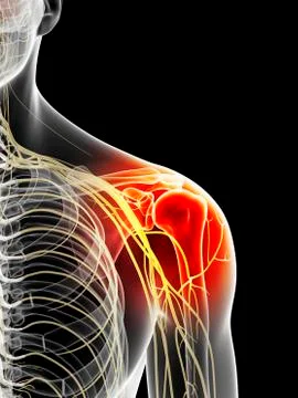 Human shoulder nerves, artwork Stock Illustration
