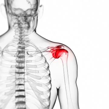 Human shoulder pain, artwork Stock Illustration