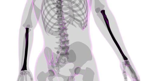 Human skeleton anatomy Radius Bone 3D Rendering Ilustración de archivo