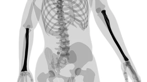 Human skeleton anatomy Radius Bone 3D Rendering 库存插图