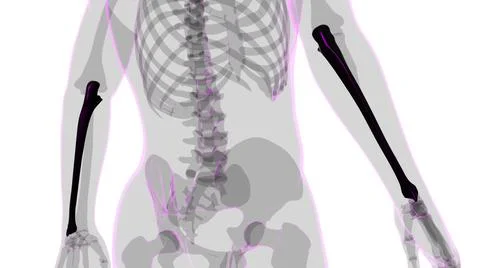 Human skeleton anatomy Ulna Bone 3D Rendering 스톡 일러스트