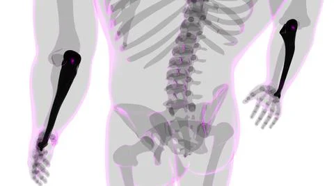 Human skeleton anatomy Ulna Bone 3D Rendering Ilustración de archivo
