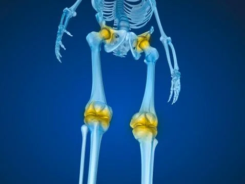 Human skeleton and damajed joints . Medically accurate 3D illustration Stock Illustration
