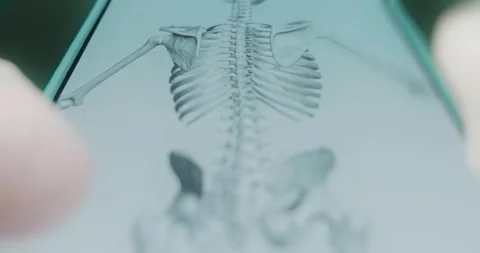 Human skeleton back view on anatomy app Stock Footage 313838676
