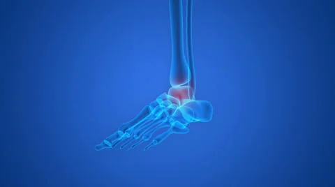 Human Skeleton Bone Joint Pains (Foot Joint) 库存影片 65783398