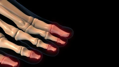 Human skeleton distal phalanges of the toe bones pain anatomy for medical c.. Stock Footage 306638939