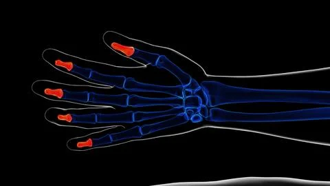 Human skeleton hand distal phalanges bone anatomy for medical concept 3D re.. Ilustración de archivo
