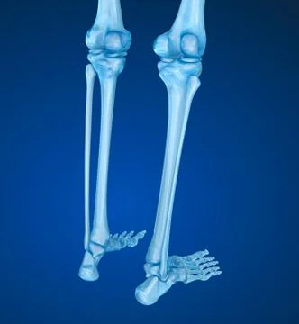 Human skeleton: Knee joint  . Medically accurate 3D illustration Stock Illustration