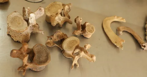 Human Skeleton Model In the Class Video stock 146286000