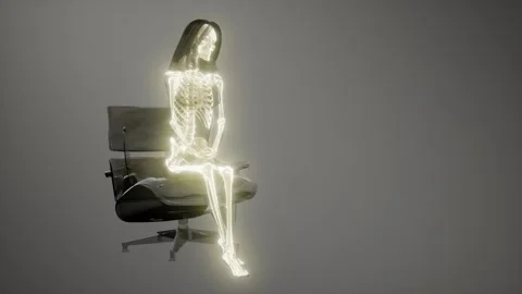 Human Skeleton Radiography Scan | Stock Video | Pond5