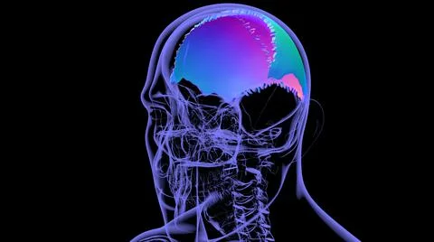 Human Skeleton Skull Parietal Bone Anatomy For Medical Concept Stock Illustration