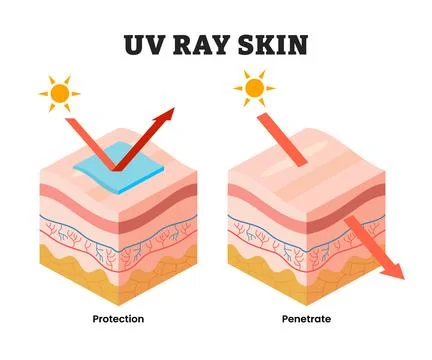 Human skin with and without sunscreen protection, educational medical poste.. Stock Illustration