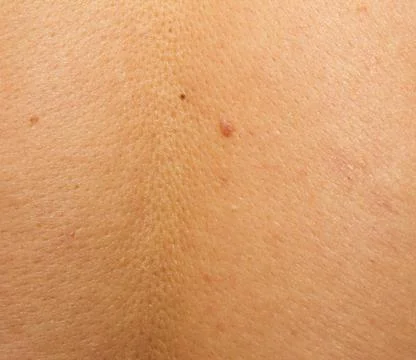Human skin as background Stock Photos