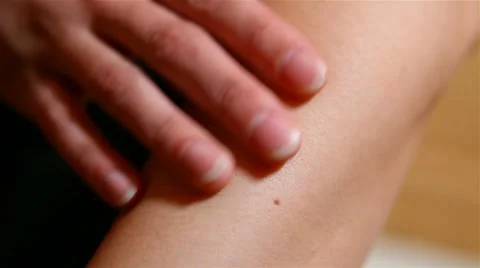 Human skin with a birthmark Stock Footage 8553708