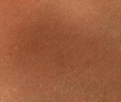 Human skin patch textue background Stock Photos