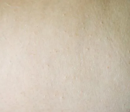 Human skin Stock Photos