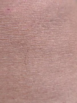 Human Skin Texture Macro Stock Photos