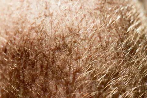Human skin texture Stock Photos