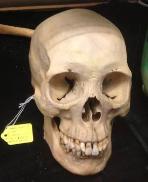 Human Skull 2 Stock Photos