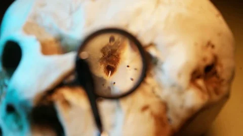 Human Skull Analysis Stock Footage 72251920